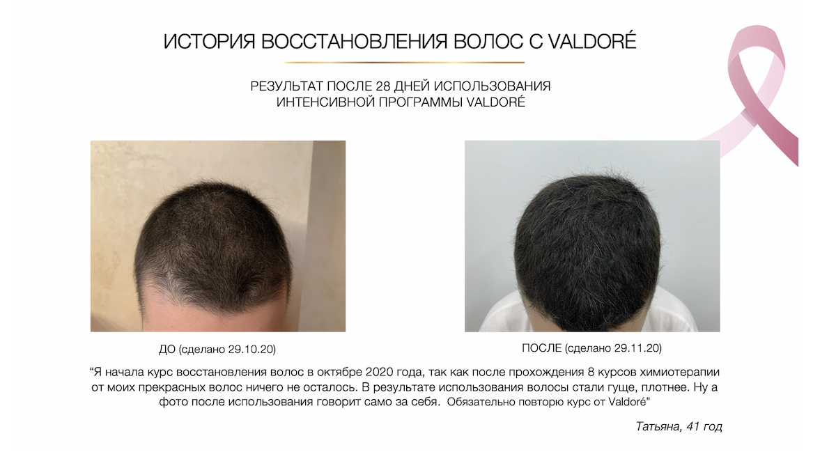 Результаты - Восстановление волос
