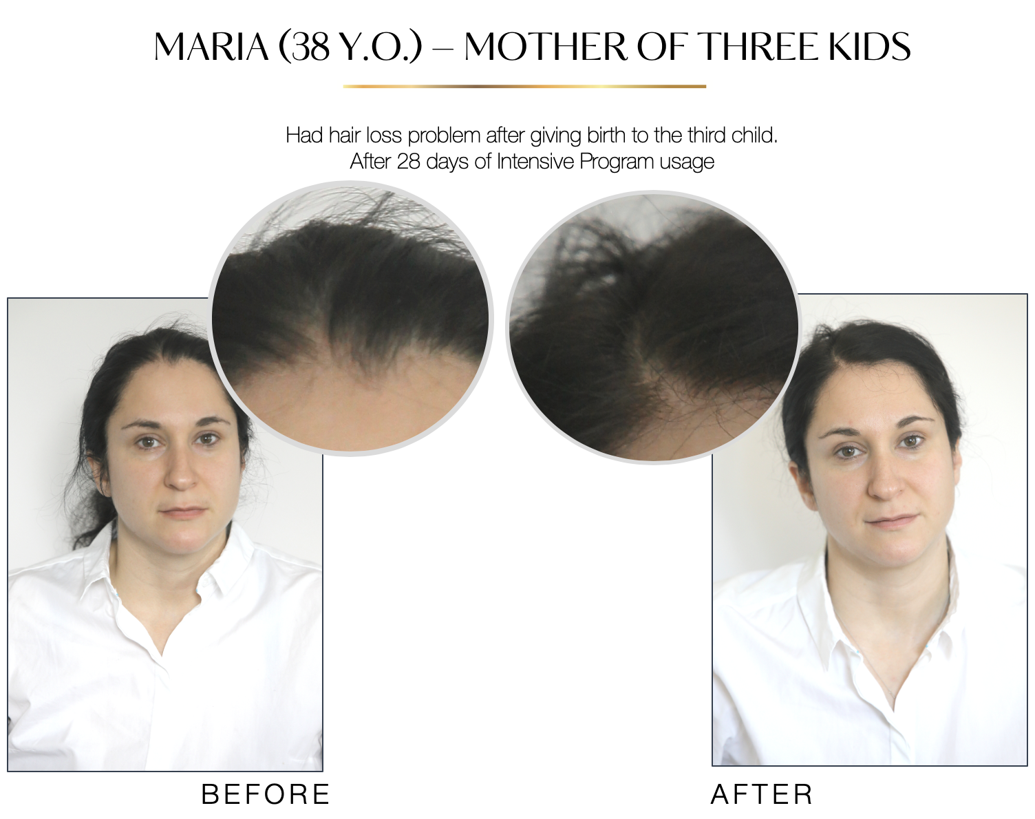 Intensive Hair Loss Prevention Program